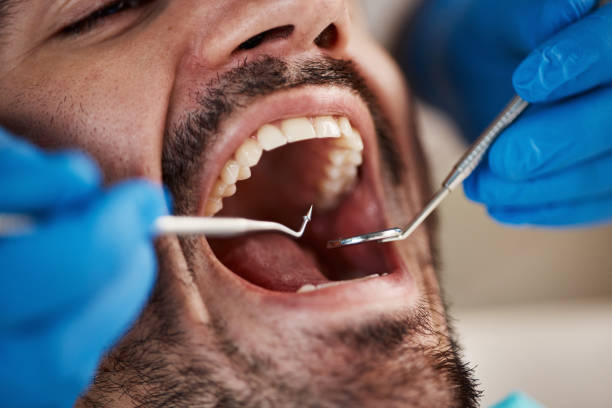 Best Emergency Dentist for Knocked-Out Tooth in Northwoods, MO